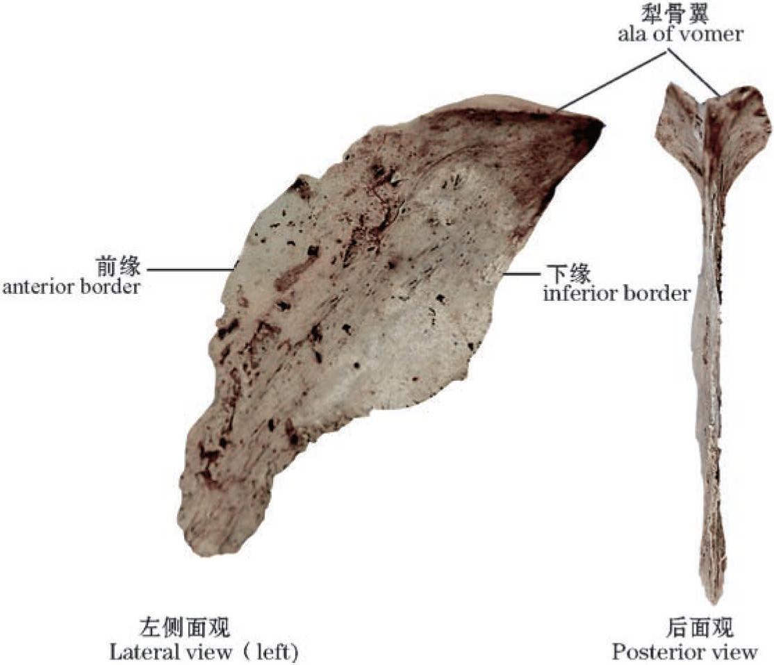 圖1-41 犁骨